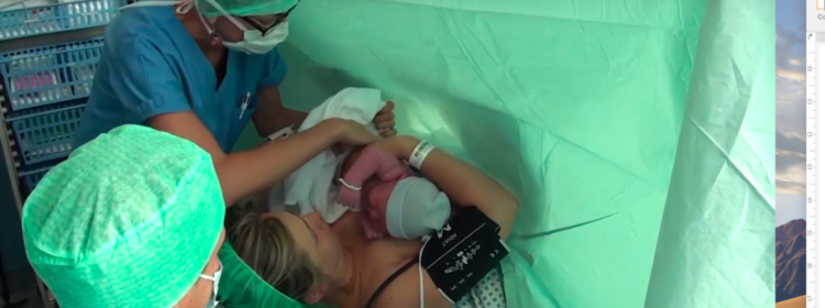 Photo d'une opération de césarienne avec une femme enceinte