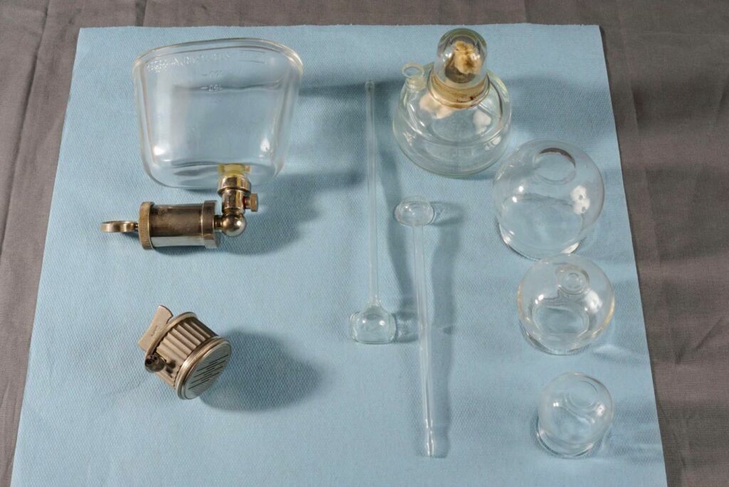 Anciennes ventouses en verres utilisées en rhumatologie et qui avaient pour réputation de "chasser les esprits"